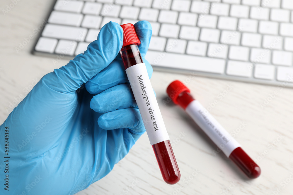 Monkeypox virus test. Laboratory worker holding sample tube with blood over table, closeup Monkeypox virus test. Laboratory worker holding sample tube with blood over table, closeup