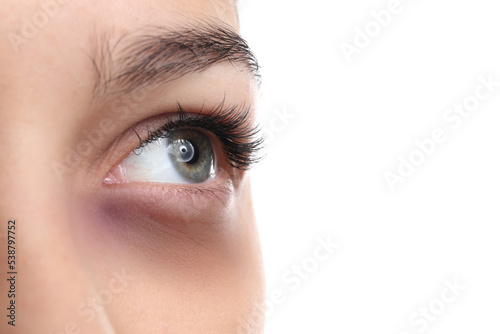 Fototapeta Naklejka Na Ścianę i Meble -  Young woman with bruise under eye on white background, closeup