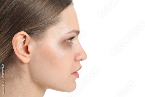 Young woman with bruise under eye on white background