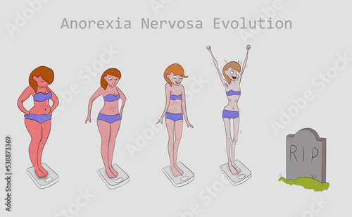 Bilde på lerret Illustration of anorexia nervosa evolution concept.