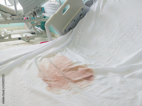 bloodstains of hospital patients on white mattress, bleeding after giving birth