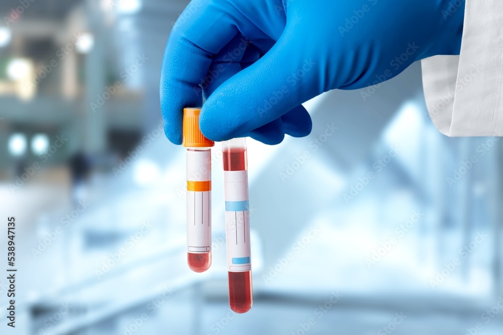 Doctor hand hold a tube with sample Doctor hand hold a tube with sample