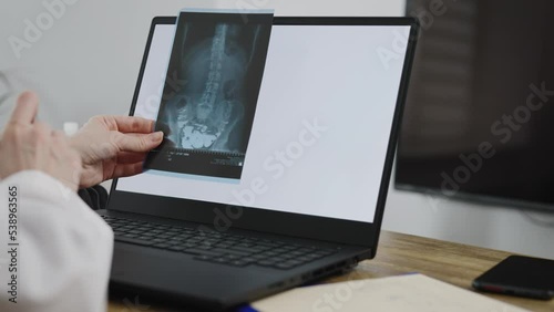 A doctor looks at an x-ray. No face photo