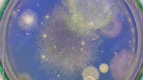 timelapse of growth of bacteria and fungi from biological samples in a petri dish