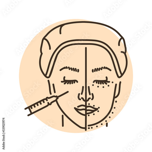 Harmonization of the profile with a filler color line illustration. Hyaluronic injection.