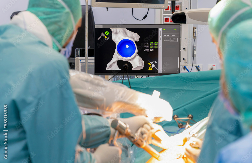 Team of doctor perform total hip arthroplasty replacement surgery in