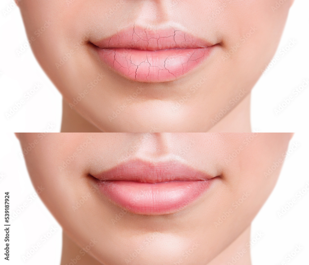 Sensual female lips before and after moistening. Sensual female lips before and after moistening.