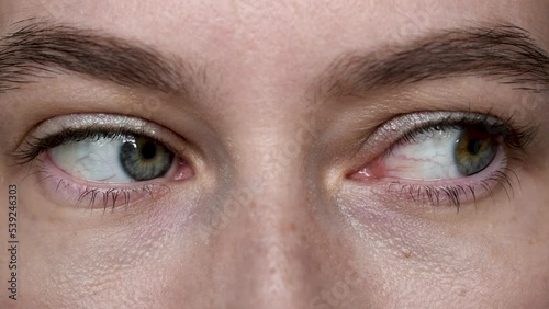 Close up of woman opens two eyes different colors, looking at the camera, looking left and right. Partial heterochromia iridum. blue and brown girl female eyes photo