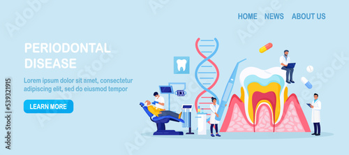 Periodontal disease. Doctor dentist checking tooth, examines patient with periodontitis. Dentistry and healthy teeth. Hygiene oral care. Stomatology. Medical dental checkup. Inflammatory gum disease