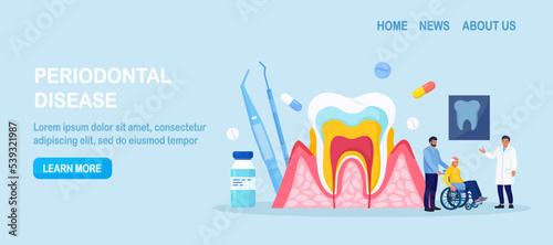 Periodontal disease. Doctor dentist checking tooth, examines patient with periodontitis. Dentistry and healthy teeth. Hygiene oral care. Stomatology. Medical dental checkup. Inflammatory gum disease