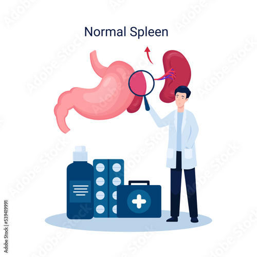 Illustration disease splenomegaly, healthy spleen photo