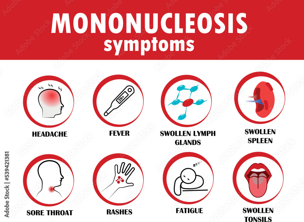 Mononucleosis symptoms. Flat style vector illustration isolated on white background. Mononucleosis symptoms. Flat style vector illustration isolated on white background.