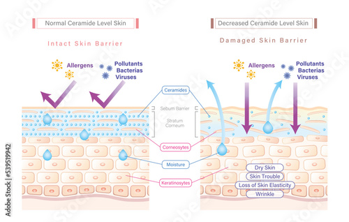 Ceramide in skin and skin barrier illustration comparing between sufficient ceramide skin and low ceramide skin. Why skin needs ceramides. photo
