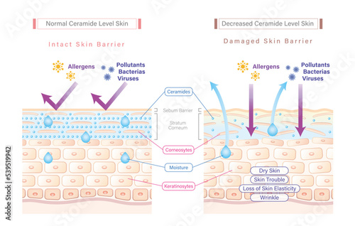Ceramide in skin and skin barrier illustration comparing between sufficient ceramide skin and low ceramide skin. Why skin needs ceramides.