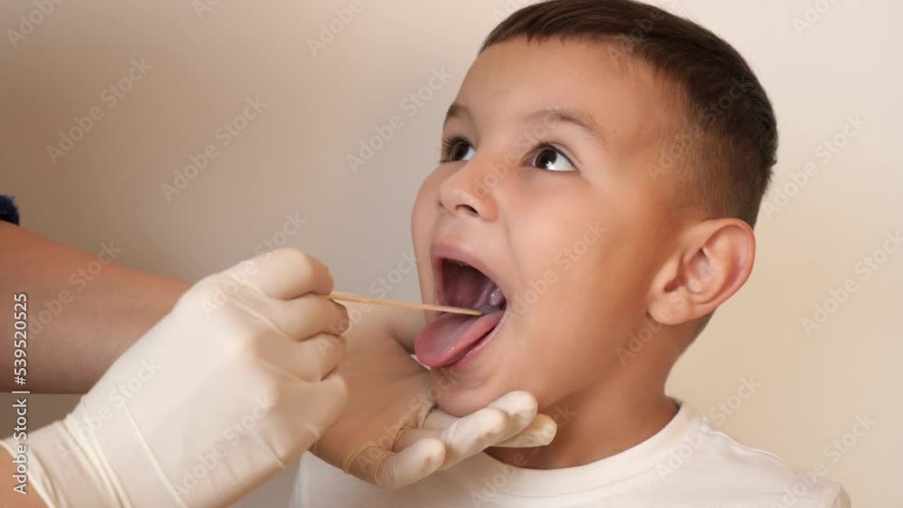 custom made wallpaper toronto digitalThe doctor uses a spatula to examine the boy's throat.