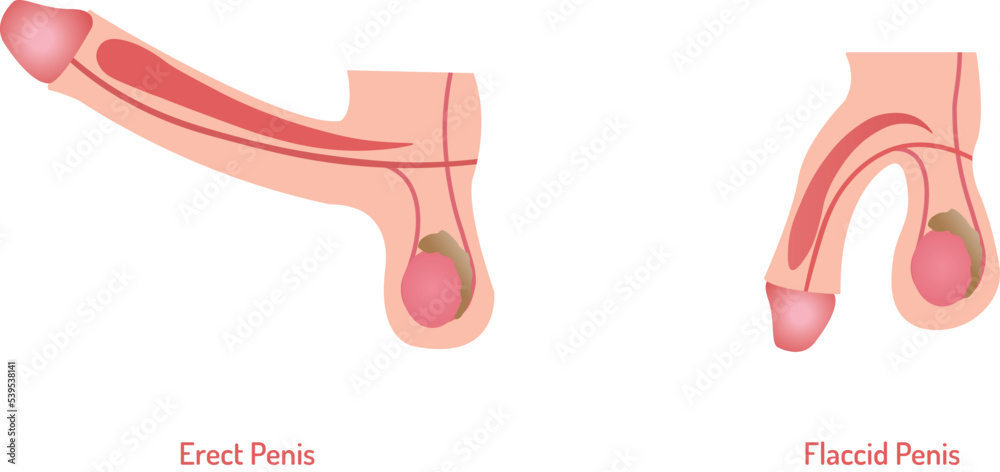 flaccid and erectile penis, erect and flaccid penis,and dick vector / sex  education / graphic Stock Vector | Adobe Stock