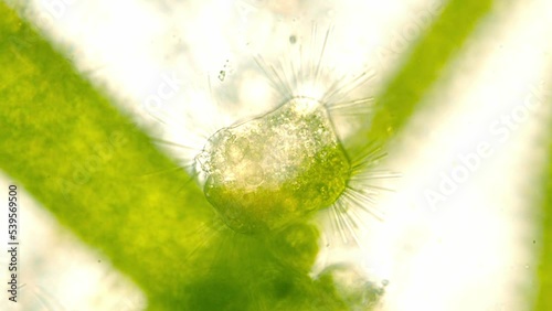 Spiked bacteria sitting on a branch of a green algae. Seen in optical microscope. 40x objective