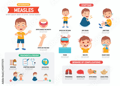 Measles infographic with children boy characters representing symptoms vector illustration photo
