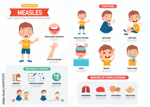 Measles infographic with children boy characters representing symptoms vector illustration