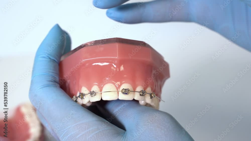 Close up dentist orthodontist holds model of human jaws with braces