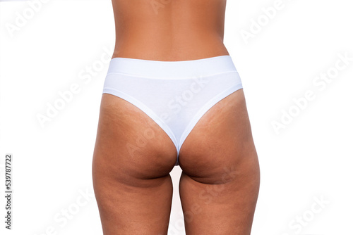 Cropped shot of young tanned woman in white panties with cellulite and white stretch marks from a weight loss or weight gain on thighs isolated on a white background. Excess weight, overweight