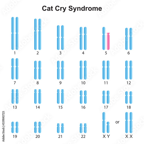 Scientific Designing of Cat Cry Syndrome Karyotype. Colorful Symbols. Vector Illustration.