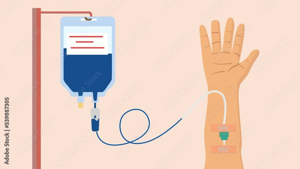 Blue fluid being transfused into someone's veins Blue fluid being transfused into someone's veins