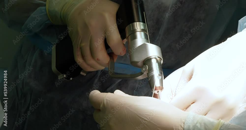 The traumatologist uses a surgical drill to insert steel pins into the paw bone of a pet to hold the fracture together. Treatment of limb fractures in animals by installing external osteosynthesis. The traumatologist uses a surgical drill to insert steel pins into the paw bone of a pet to hold the fracture together. Treatment of limb fractures in animals by installing external osteosynthesis.