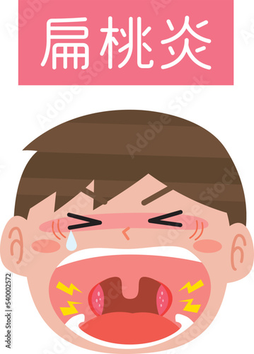扁桃腺が痛い男の子