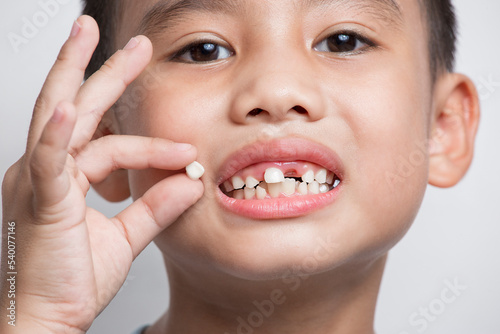 close up face baby Asian hold showing open mouth temporary lost tooth teeth milk tooth