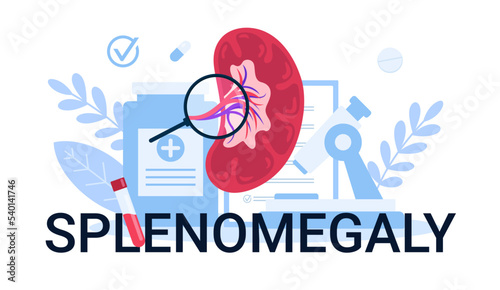 Illustration splenomegaly diseases anatomy for medical, Design can be used for websites, landing pages,mobile apps, ui ux, banners photo