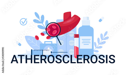 Illustration atherosclerosis diseases anatomy for medical, Design can be used for websites, landing pages,mobile apps, ui ux, banners
