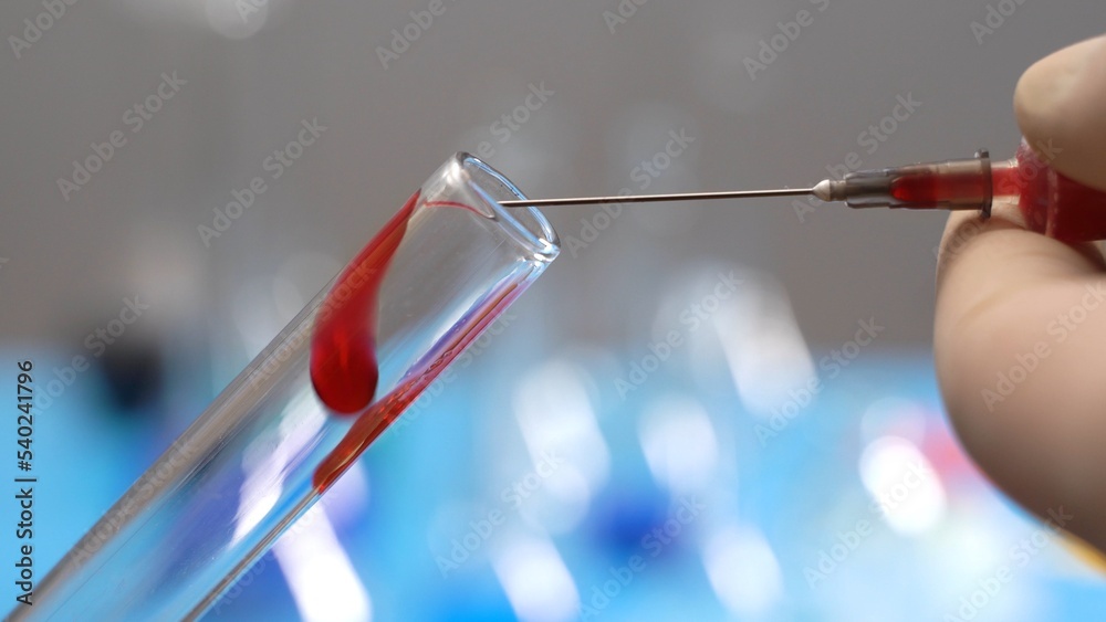 Drops of blood flow from the needle into the vial. Experiment in the laboratory Drops of blood flow from the needle into the vial. Experiment in the laboratory