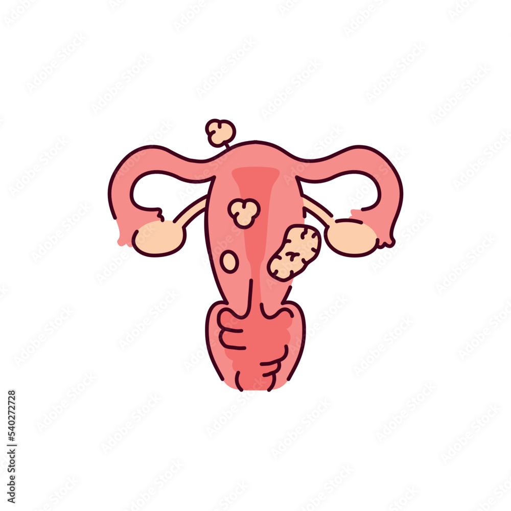 Uterine myoma color line icon. Gynecology problem Uterine myoma color line icon. Gynecology problem