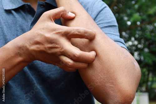 man suffering from itching skin, close up.