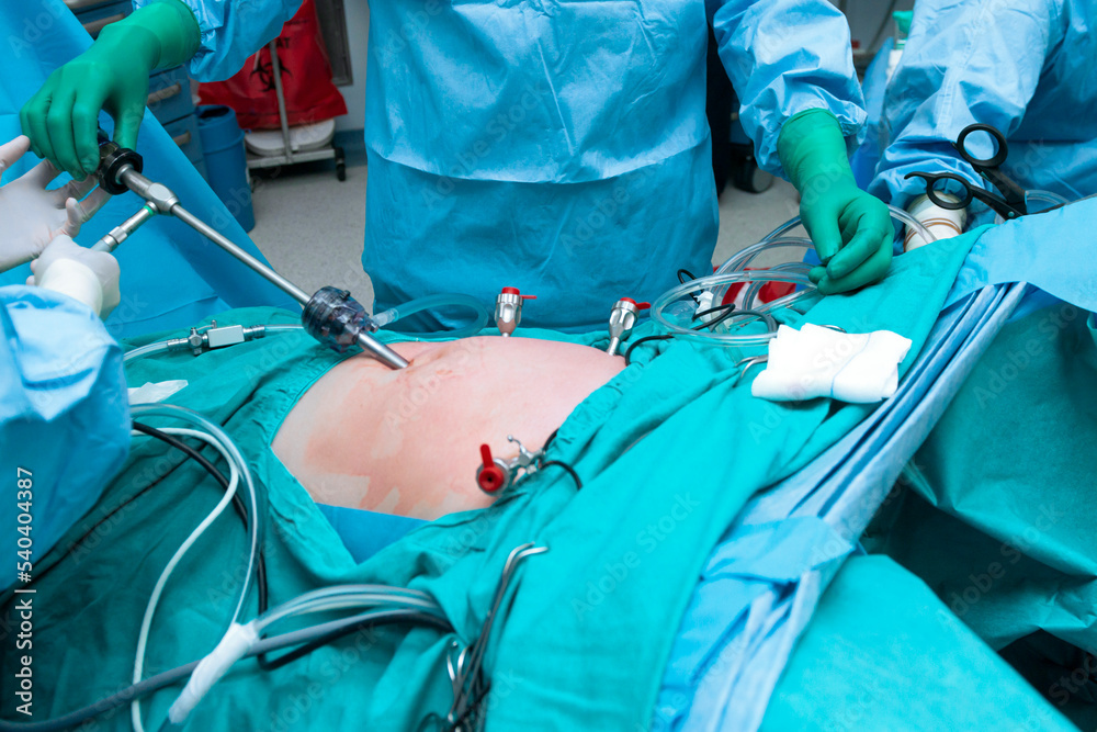 Group of surgeons doing surgery in hospital operating theater operating room Group of surgeons doing surgery in hospital operating theater operating room