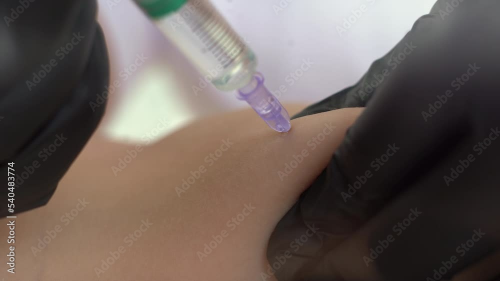 Close up of cosmetologist makes injections to burn fat on the stomach and waist of a woman. Female aesthetic cosmetology in a beauty salon.Cosmetology Close up of cosmetologist makes injections to burn fat on the stomach and waist of a woman. Female aesthetic cosmetology in a beauty salon.Cosmetology