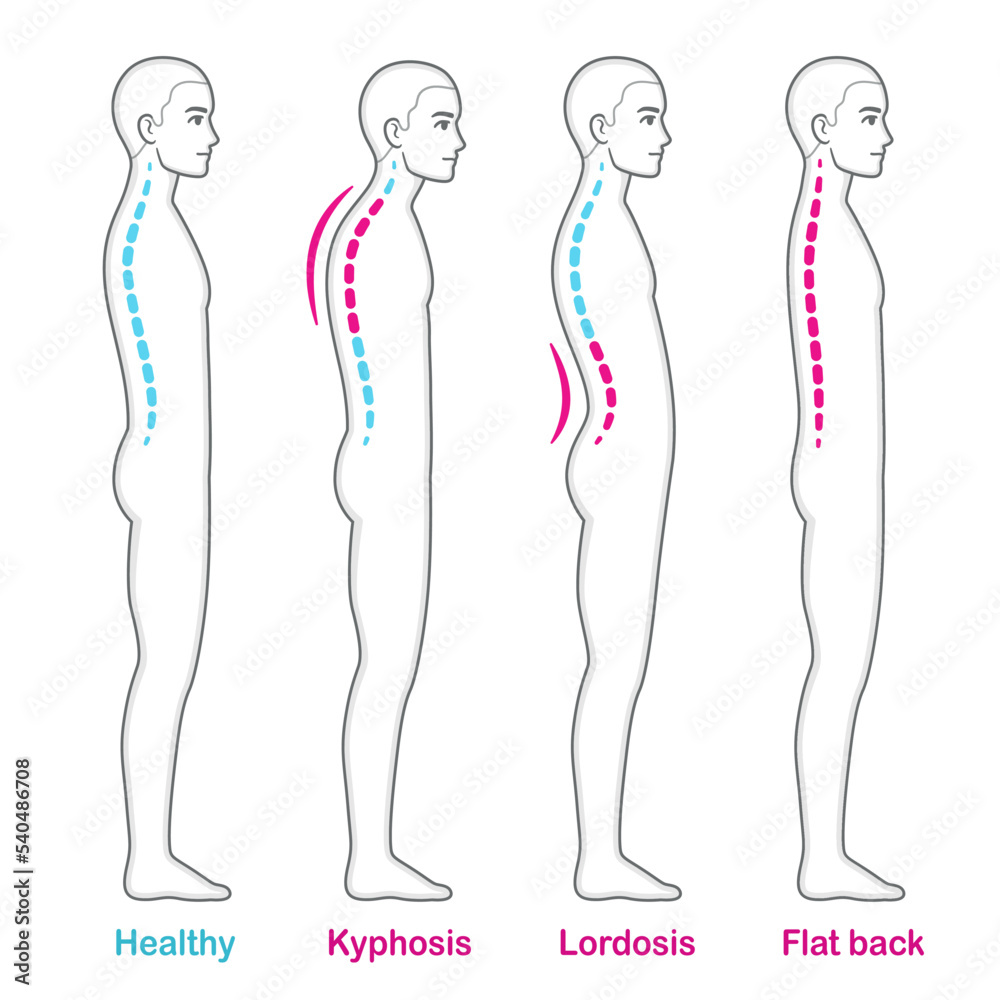 Posture and back problems spine infographic Posture and back problems spine infographic