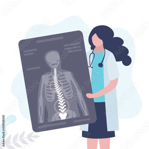 Orthopedist holding x-ray with curved back. Doctor noted in picture places of spinal deformity