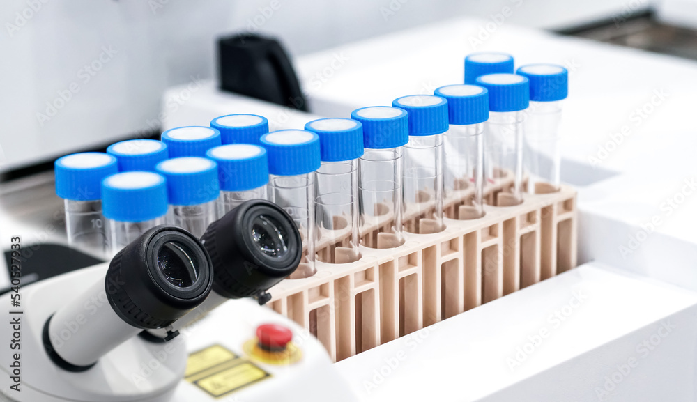 Microscope with Many test tubes in the laboratory. Concept collection of blood in cases for analysis. 