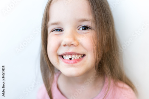 Losing the first baby teeth. Cute girl showing her fall out tooth and waiting visits from the tooth fairy.