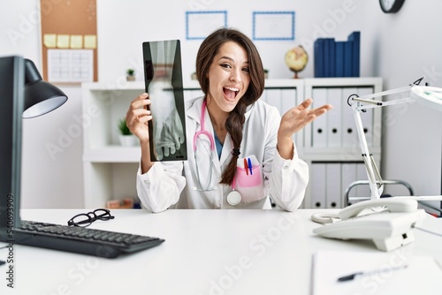 Young doctor woman holding foot x-ray celebrating achievement with happy smile and winner expression with raised hand