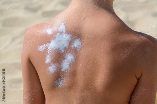 Child with sunscreen on back at beach, closeup