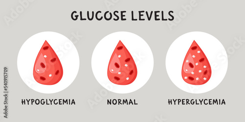 Glucose blood level infographic. Hypoglycemia, hyperglycemia and normal blood sugar. Flat vector medical illustration
