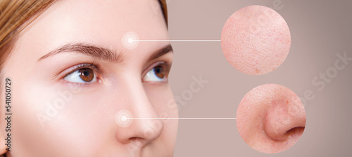 Young woman with zoom circle before and after treatment or retouch. Beautician concept. photo