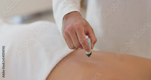 Wellness, medicine and heat acupuncture on back of female client on spa bed with therapist for moxibustion or moxa smoke therapy. Spiritual healing, body and stress relief with Chinese treatment photo