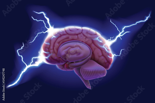 3D illustration of cerebral hemispheres with lightning floating on a dark blue background. medical use education and science.
