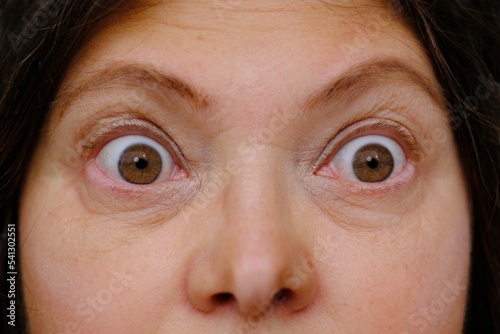 middle-aged mature woman with bulging eyes, upper face close-up, goggle eyes in fright, staring at camera, Very strong surprise or fright, horror in look, concept of cosmetic anti-aging procedures photo