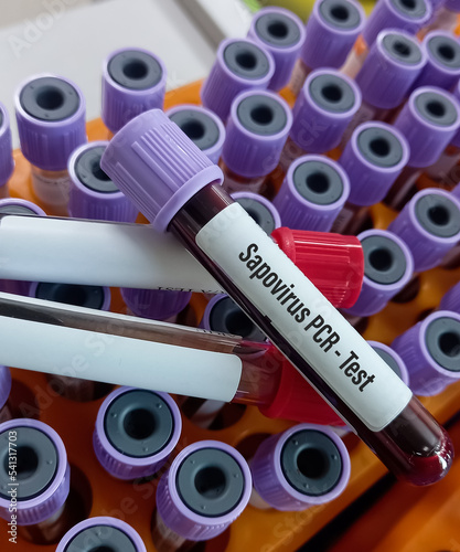 Blood sample for Sapovirus PCR test, health and medical concept photo