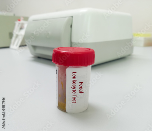 Stool sample in a container for Fecal leukocyte test to diagnosis of diarrheal disease. photo